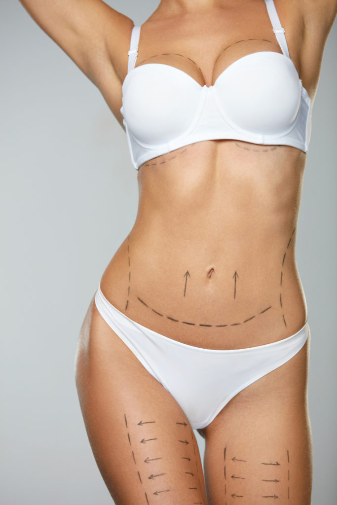 How Long After Breast Augmentation Can I Swim, Exercise, or Fly?