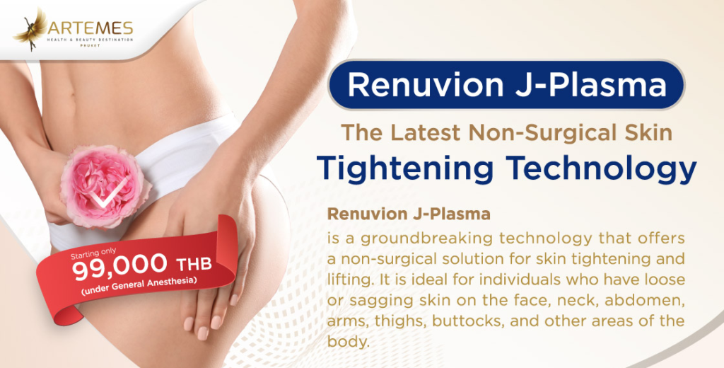 Renuvion J-Plasma